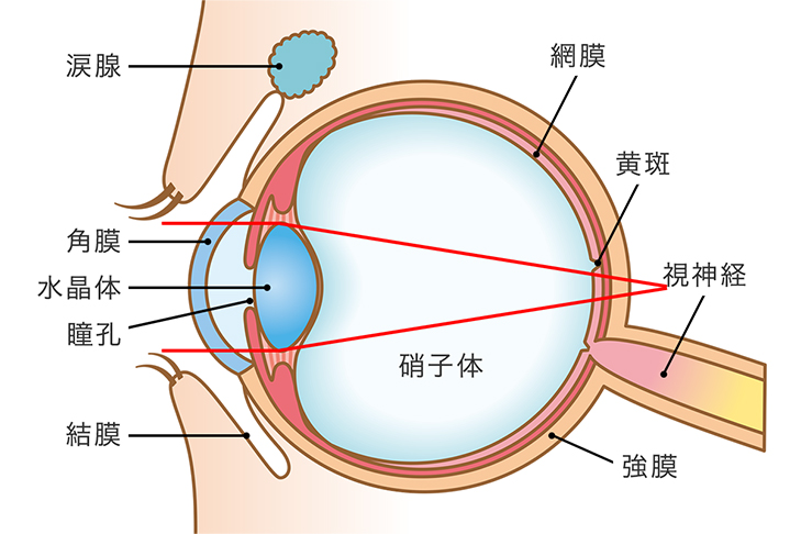 網膜に届いてはいますが、網膜の後ろ（頭の奥）でピントが合っている状態です。