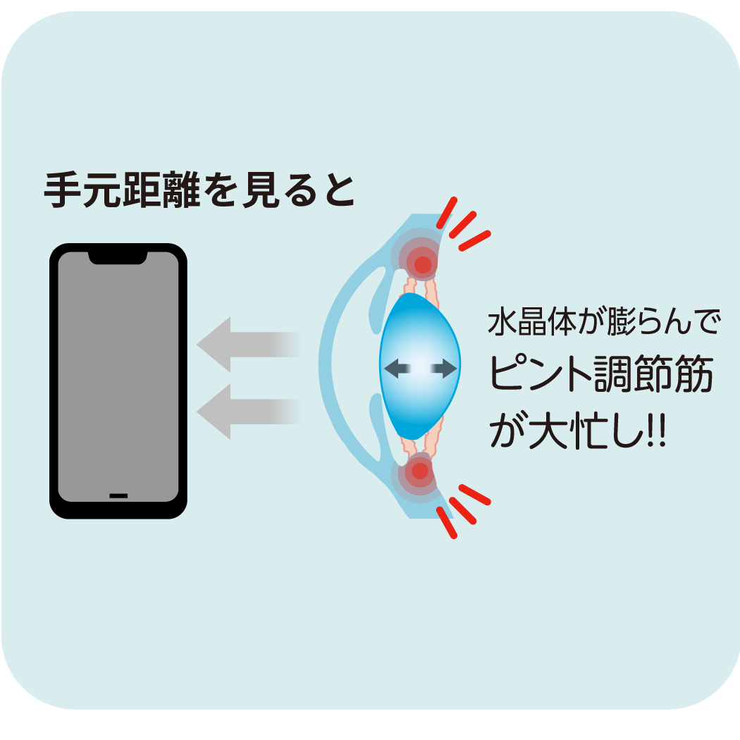 疲れ目の主な原因は「目のピント調節力」を駆使すること