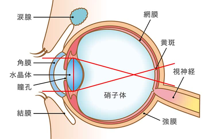 網膜まで光が届いていないため、遠くが見えません。
